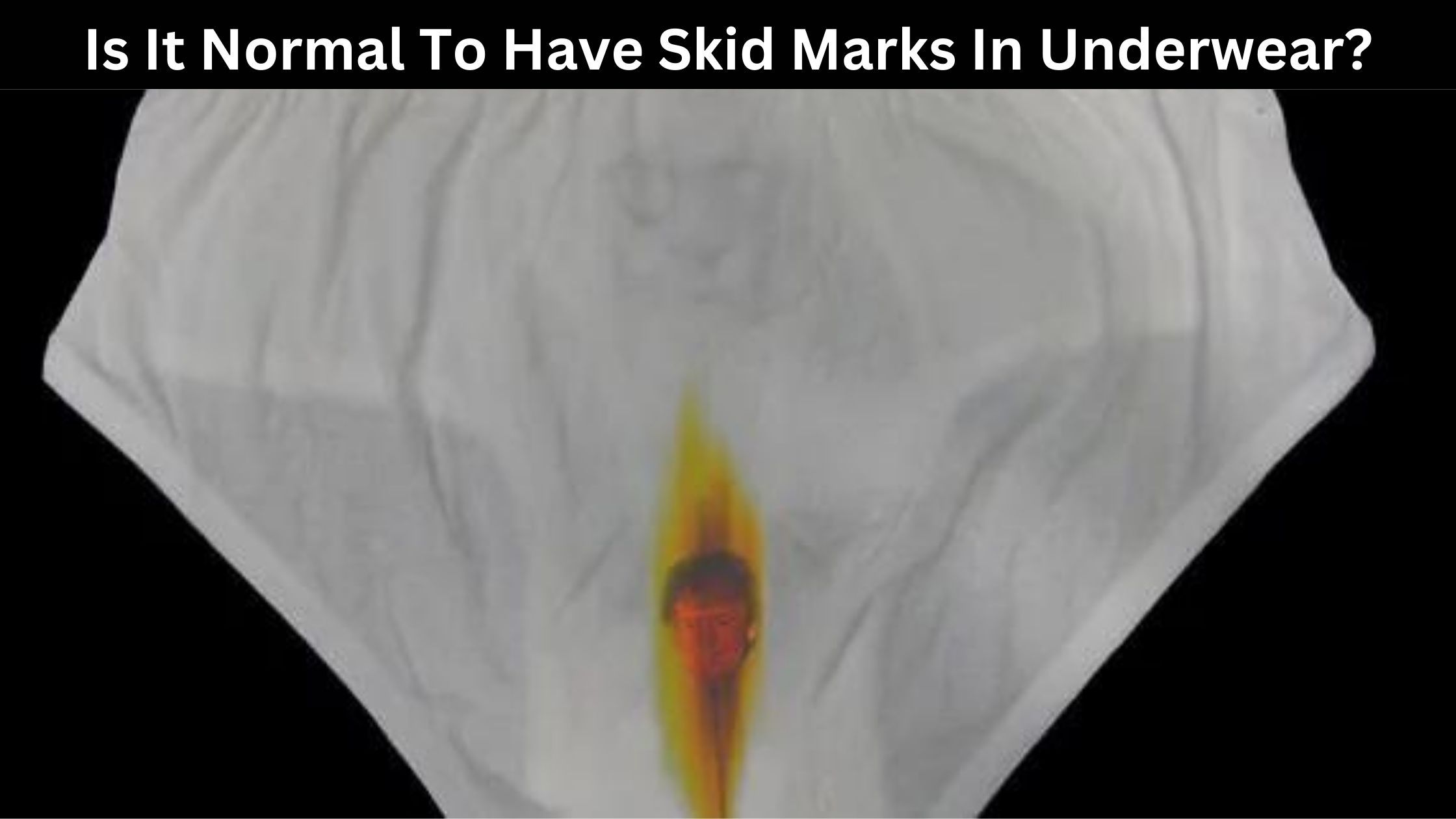 Is It Normal To Have Skid Marks In Underwear
